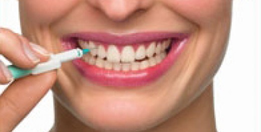 Dünne Porzellan-Zahnschalen (Veneers) für das perfekte Lächeln - Zahnklinik OZ 95