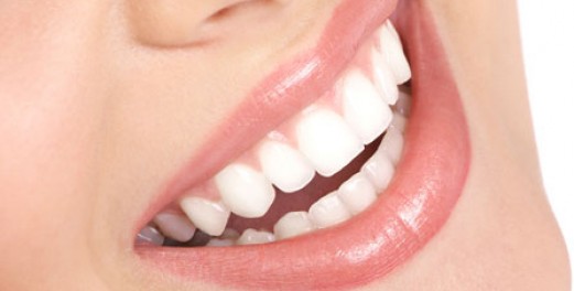 Dünne Porzellan-Zahnschalen (Veneers) für das perfekte Lächeln - Zahnklinik OZ 95